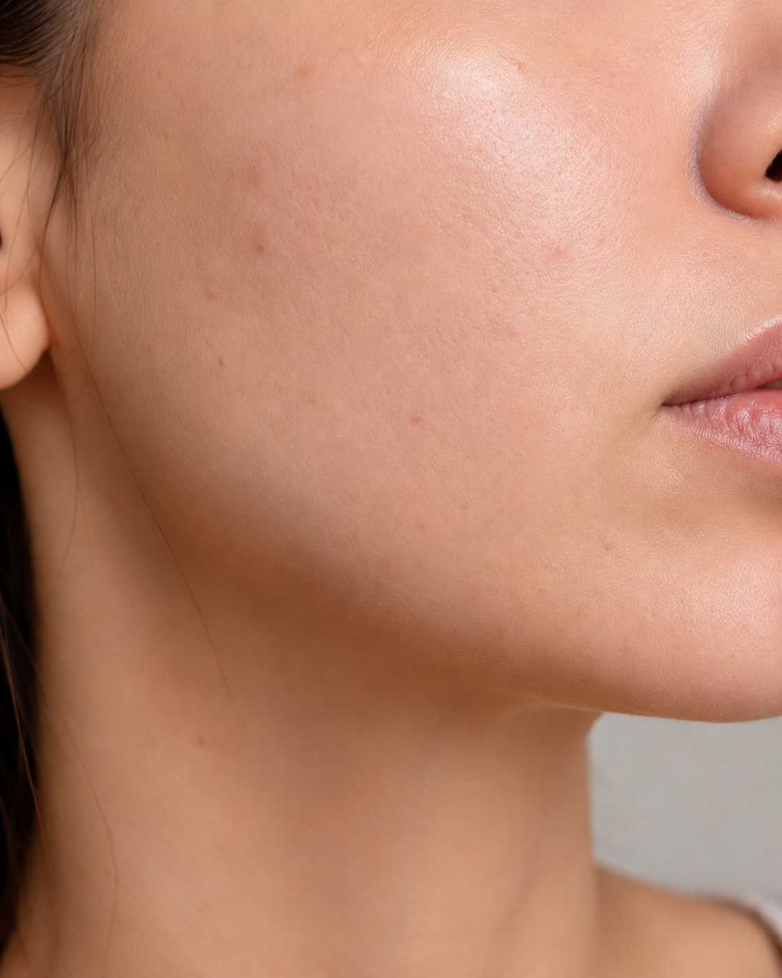 Close-up van huidtextuur met zichtbaar rustigere huid na consistente skincare routine